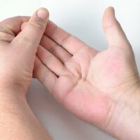 4 warning signs of Dupuytren&#8217;s contracture