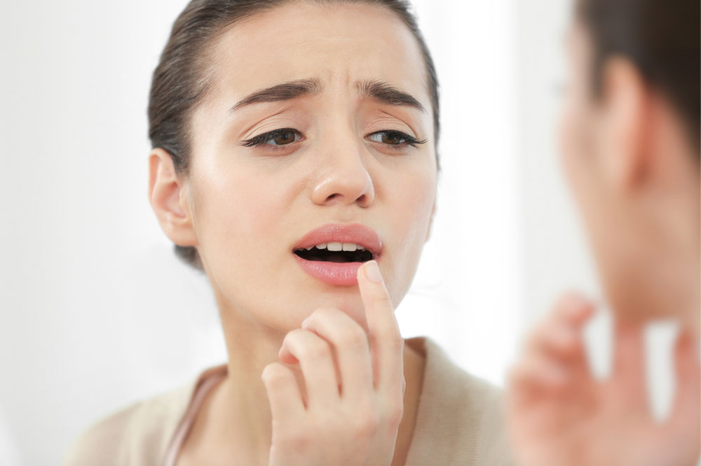 5 simple remedies for cold sores